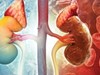 Thói quen ăn tối muộn có thể làm tăng nguy cơ tổn thương thận