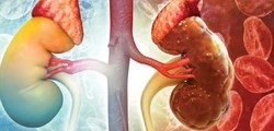 Thói quen ăn tối muộn có thể làm tăng nguy cơ tổn thương thận