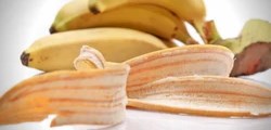 Vỏ và lá chuối có chữa được bệnh?