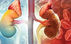 Thói quen ăn tối muộn có thể làm tăng nguy cơ tổn thương thận