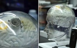 Trung Quốc thử nghiệm chip đọc não Beinao-1: Tuyên chiến với Neuralink của Elon Musk trong cuộc đua công nghệ BCI