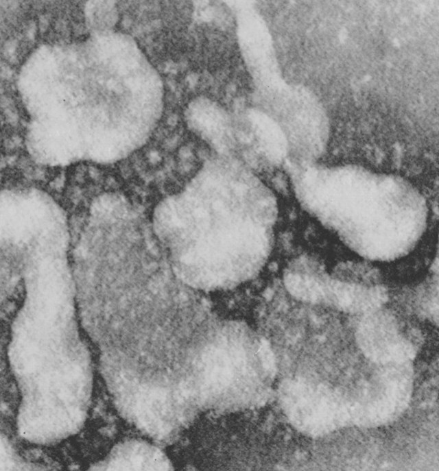 H&igrave;nh ảnh virus corona đầu ti&ecirc;n do June Almeida chụp được v&agrave;o năm 1966. Ảnh:&nbsp;Microbiology Research.